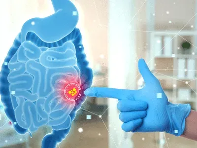 Analyse du microbiote : les nouvelles solutions de la préparation microbiologique