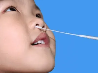 Coqueluche – Reprise épidémique : enjeux et diagnostic