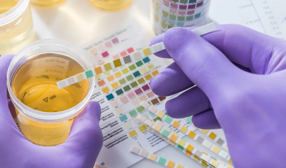Laboratoires: aidez vos patients à savoir comment recueillir les urines de 24 heures