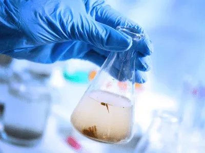 Les risques de contamination microbiologique des eaux : Coliformes et legionella