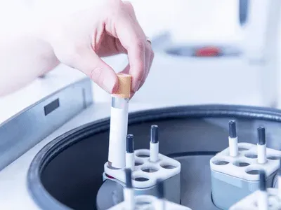 Service de qualification des centrifugeuses : faites contrôler vos appareils !